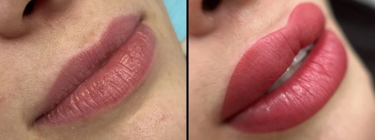 Side-by-side export: lips before and after treatment, both frames shot from the same angle and distance.
